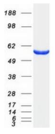 SDS-PAGE (UGDH-2072HFL).jpg